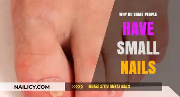 Understanding the Genetics and Factors Behind Naturally Small Nails