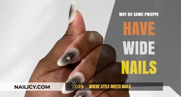 Why Some People Have Wide Nails: Causes and Insights