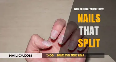 Why Do Some People Have Nails That Split? Causes and Solutions