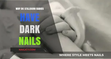 Understanding Stillborn Babies' Dark Nails: Causes and Medical Insights