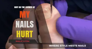Why Do the Corners of My Nails Hurt? Causes and Remedies