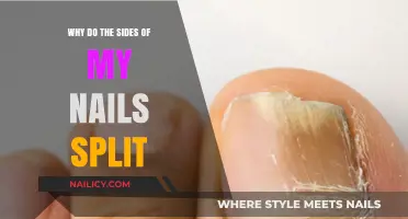 Why Do My Nail Sides Split? Causes and Solutions Explained