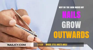 How to Stop Unsightly Nail Bed Skin Growths