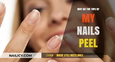 Why Do My Nail Tips Peel? Causes and Solutions Explained