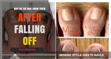 Toe Nail Thickening: What Happens After They Fall Off