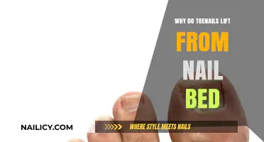 Why Toenails Lift: Causes, Prevention, and Treatment Options Explained