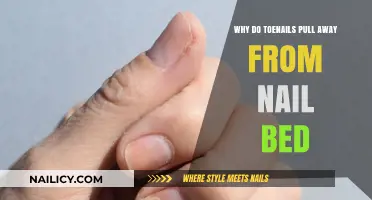 Toenail Separation Explained: Causes and Solutions for Nail Bed Issues