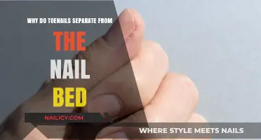 Toenail Separation Explained: Causes and Solutions for Healthy Feet
