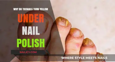 Why Toenails Turn Yellow Under Nail Polish: Causes and Solutions