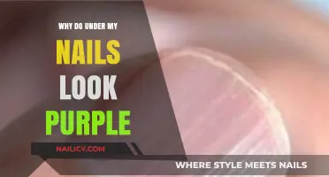 Why Do My Nails Look Purple? Causes and Concerns Explained