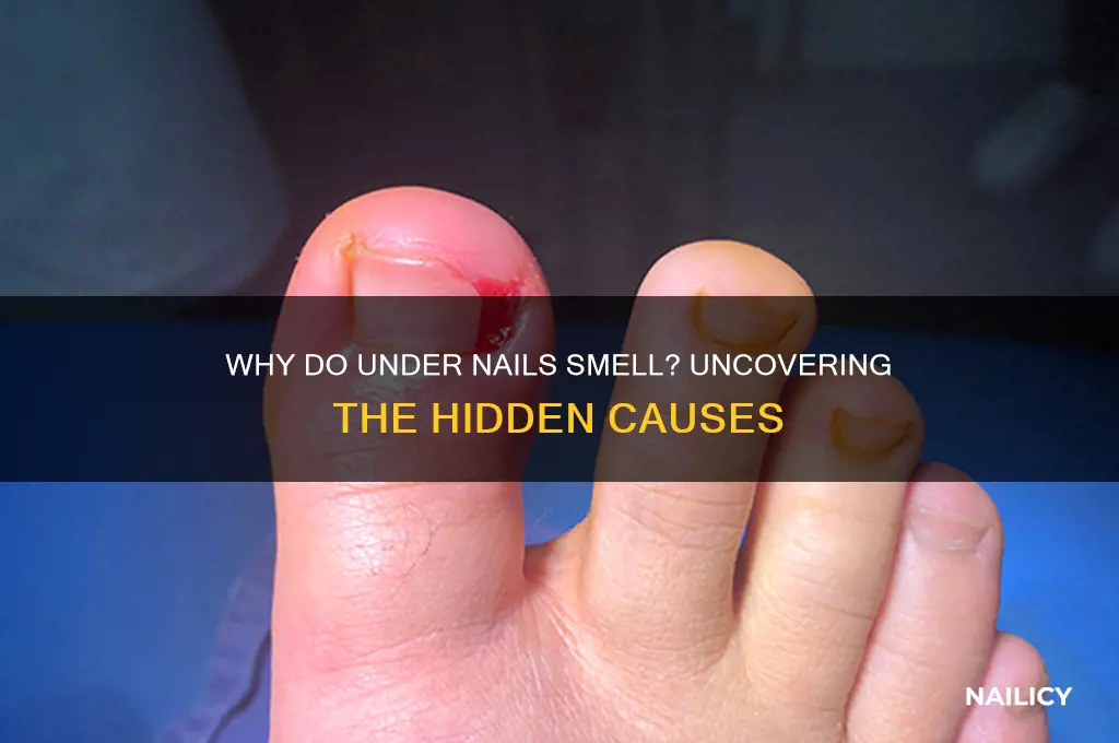 why do under nails smell