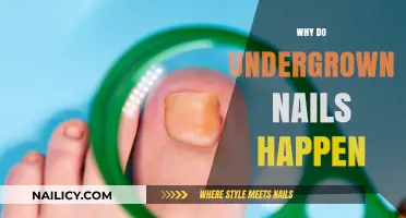 Understanding Ingrown Nails: Causes, Prevention, and Effective Treatment Options