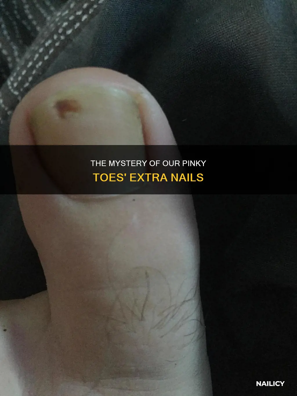 why do we grow extra nail on pinky toe