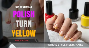 Why White Nail Polish Turns Yellow: Causes and Prevention Tips