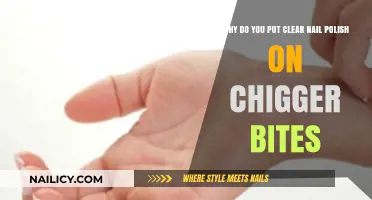 Clear Nail Polish for Chigger Bites: Does It Really Work?