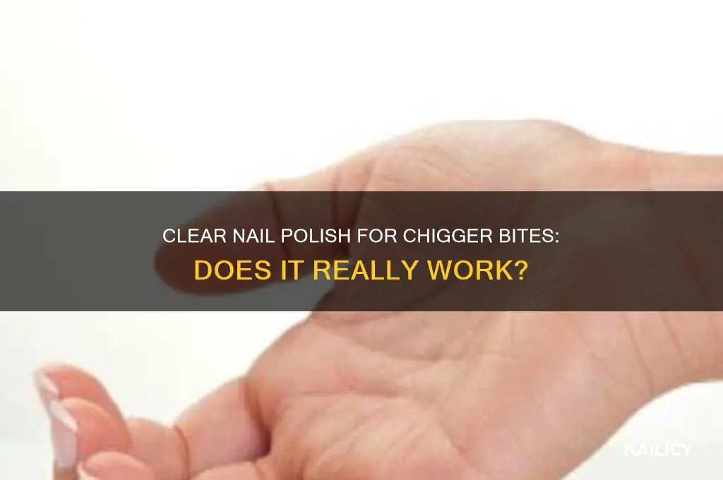 why do you put clear nail polish on chigger bites
