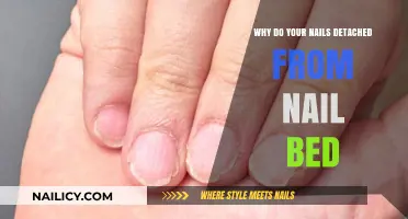Nail Detachment Explained: Causes and Solutions for Separated Nails