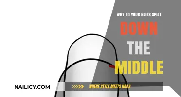 Why Do Your Nails Split Down the Middle? Causes and Solutions