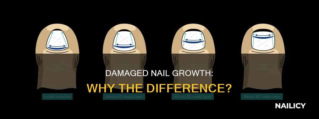 why does a damaged nail grow back differently