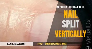 The Science Behind Vertical Nail Splits: Unlocking the Mystery