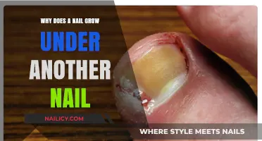 Understanding Ingrown Nails: Causes and Treatment