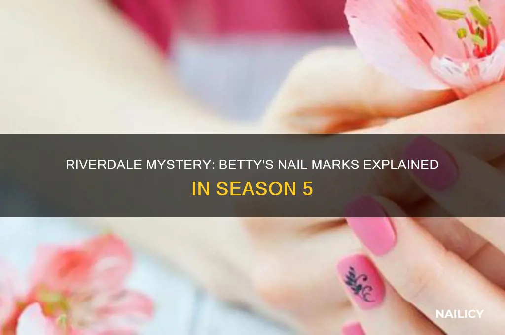 why does betty have nail marks riverdale