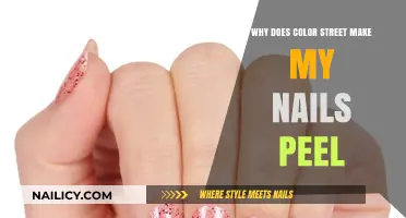 Why Color Street Causes Peeling Nails: Understanding the Issue