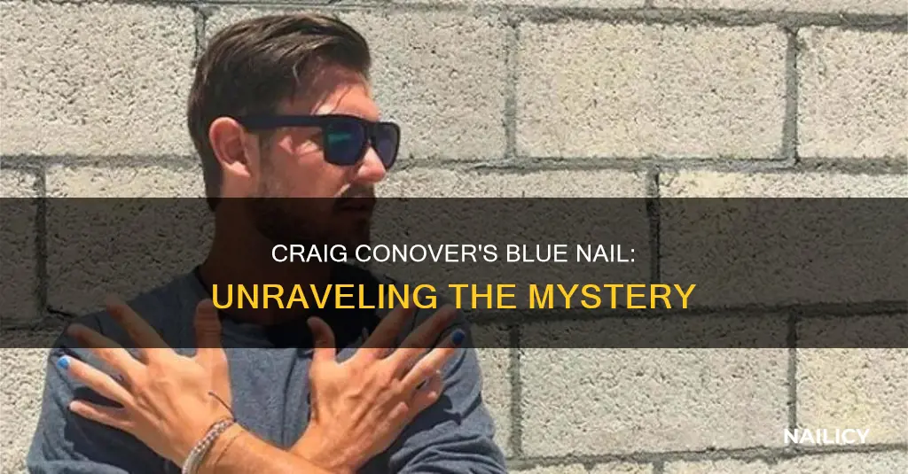 why does craig conover have a blue finger nail