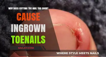 Short Nails: Ingrown Toenail Culprit?