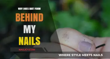 Why Dirt Accumulates Under Nails: Causes and Prevention Tips