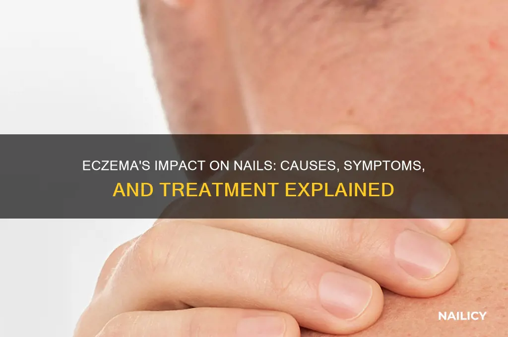 why does eczema affect nails