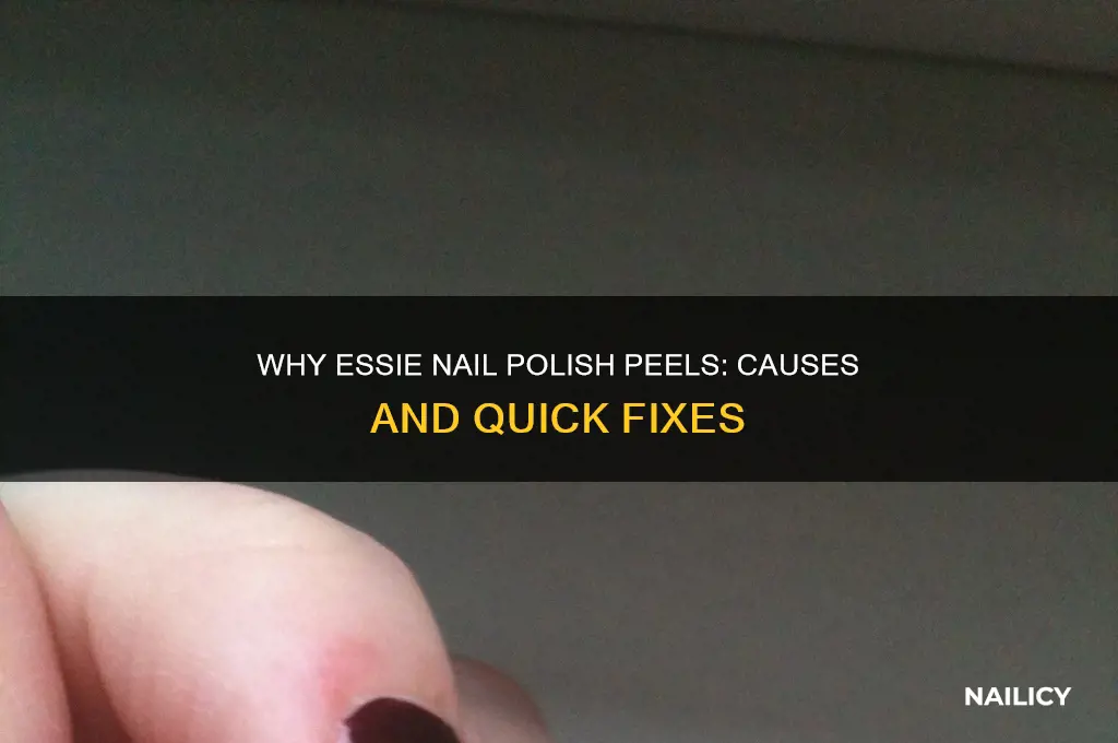 why does essie nail polish peel