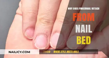 Why Fingernails Detach: Causes and Solutions for Nail Separation