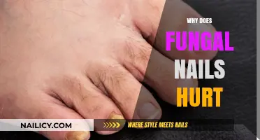 Why Fungal Nail Infections Cause Pain and Discomfort Explained