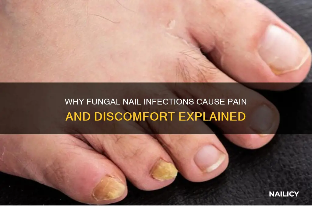 why does fungal nails hurt