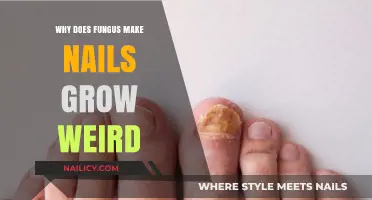 Fungal Infections: Unraveling the Mystery of Distorted Nail Growth
