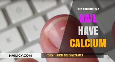 Why Half My Nail Has Calcium: Causes and Solutions