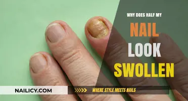 Swollen Nail Concerns: Understanding the Causes and Solutions