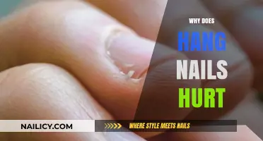Why Hangnails Cause Sharp Pain and How to Prevent Them