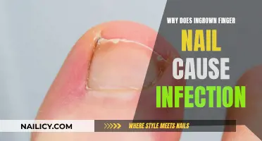 Ingrown Toenails: The Hidden Infection Threat