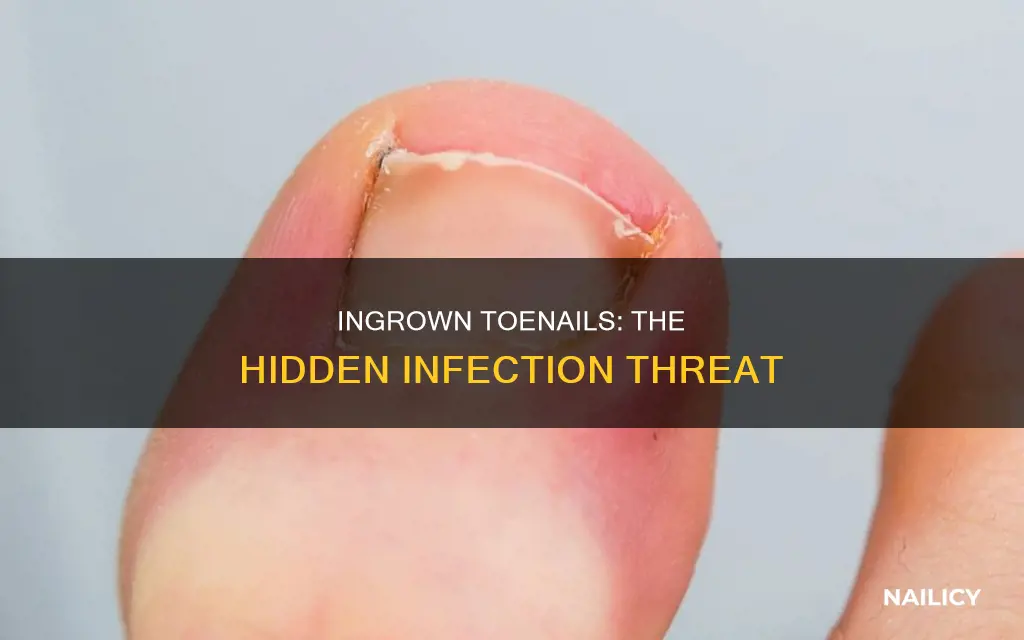 why does ingrown finger nail cause infection