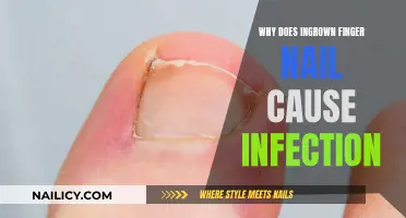 Ingrown Nails: Infection Risk and Prevention Strategies
