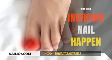 Understanding Ingrown Nails: Causes, Prevention, and Effective Treatment Options