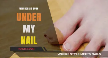 Why Does It Burn Under My Nail? Causes and Remedies Explained