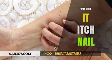 Why Do Nails Itch? Uncovering the Causes and Solutions