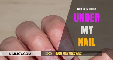 Why Does It Itch Under My Nail? Causes and Remedies