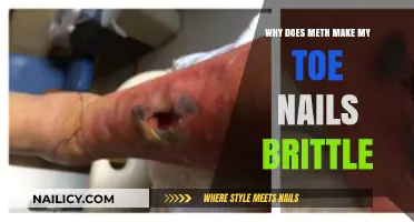 Meth's Impact: Understanding Brittle Toenails and Other Side Effects