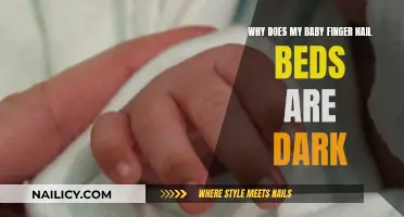 Baby's Dark Fingernail Beds: What's the Concern?