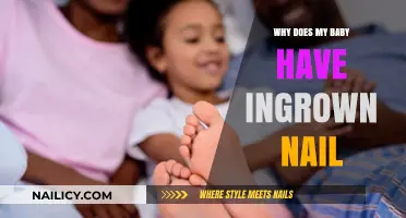 Understanding Ingrown Nails in Babies: Causes, Prevention, and Gentle Care Tips
