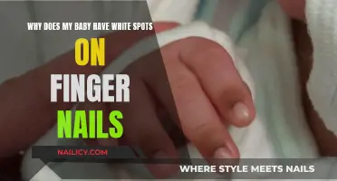 White Spots on Baby's Nails: What's the Cause?